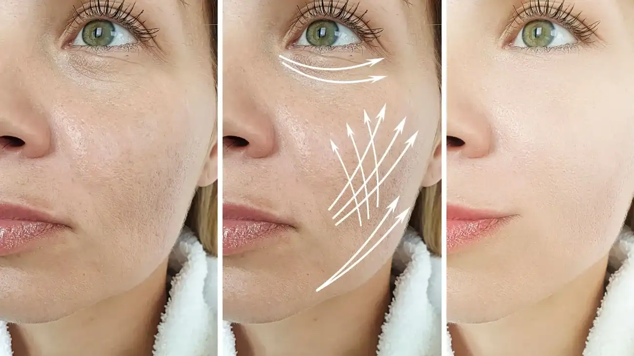 Can One Treatment Really Tackle More Than One Skin Concern Cookham?