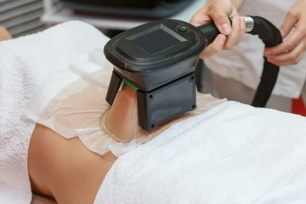 Image of person having fat freezing treatment to help weight gain Cookham