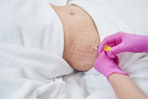 image of fat dissolving injections on love handles to help combat weight gain Cookham