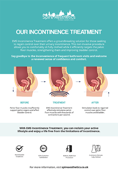image to show how EMS treatment works for female urinary incontinence Cookham