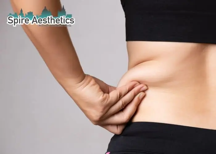 Image of woman pinching fat on their hips Cookham. Fat Freezing treatment