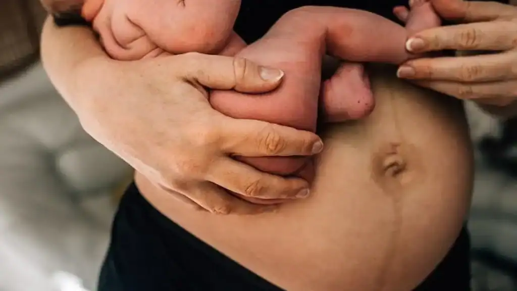 Why Is My Stomach Still Big After Pregnancy Cookham?